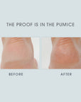 Lavender & Eucalyptus Foot Crème before and after images of a person's heel. The before image looks dry and rough, the after image looks smooth and soft.