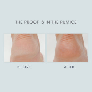 Lavender & Eucalyptus Foot Crème before and after images of a person's heel. The before image looks dry and rough, the after image looks smooth and soft.